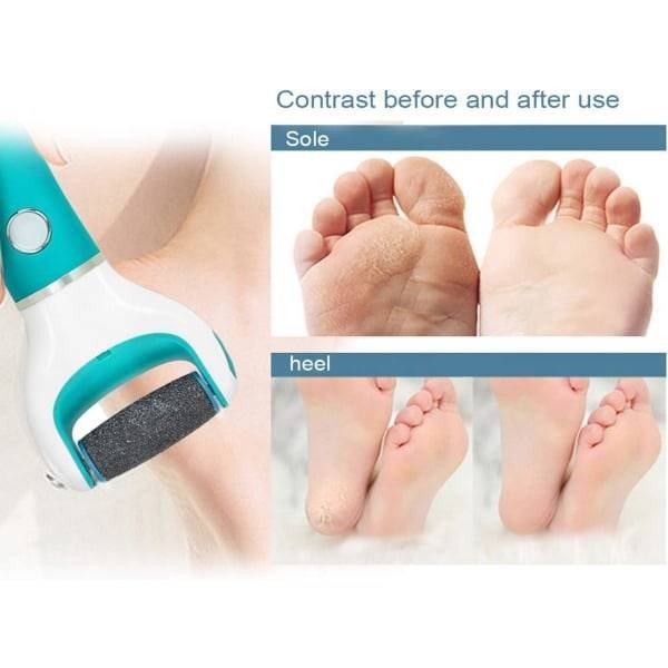 [9-pack] Scholl Velvet Smooth Pedi Replacement Rollers - yux